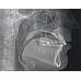 KaVo 3D eXam / i-CAT - аппарат панорамный рентгеновский стоматологический с функцией томографии